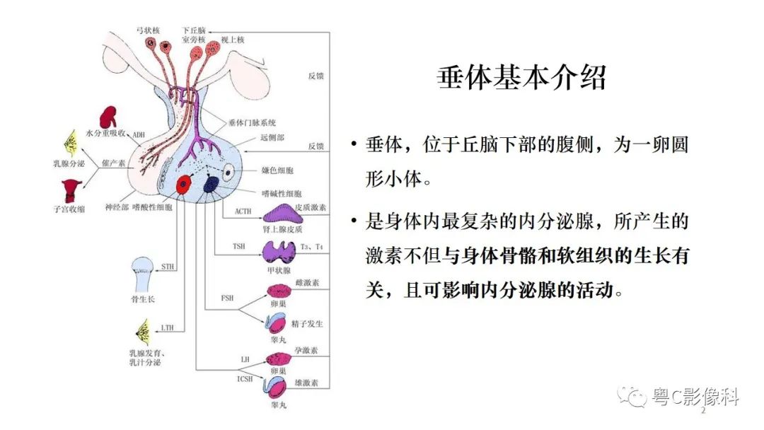 影像PPT - 【PPT】垂体的正常MR表现及儿童垂体病变的MR表现-2