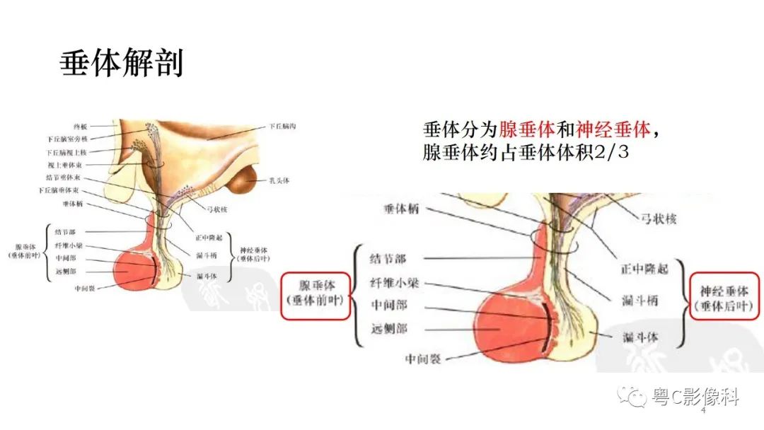 影像PPT - 【PPT】垂体的正常MR表现及儿童垂体病变的MR表现-4