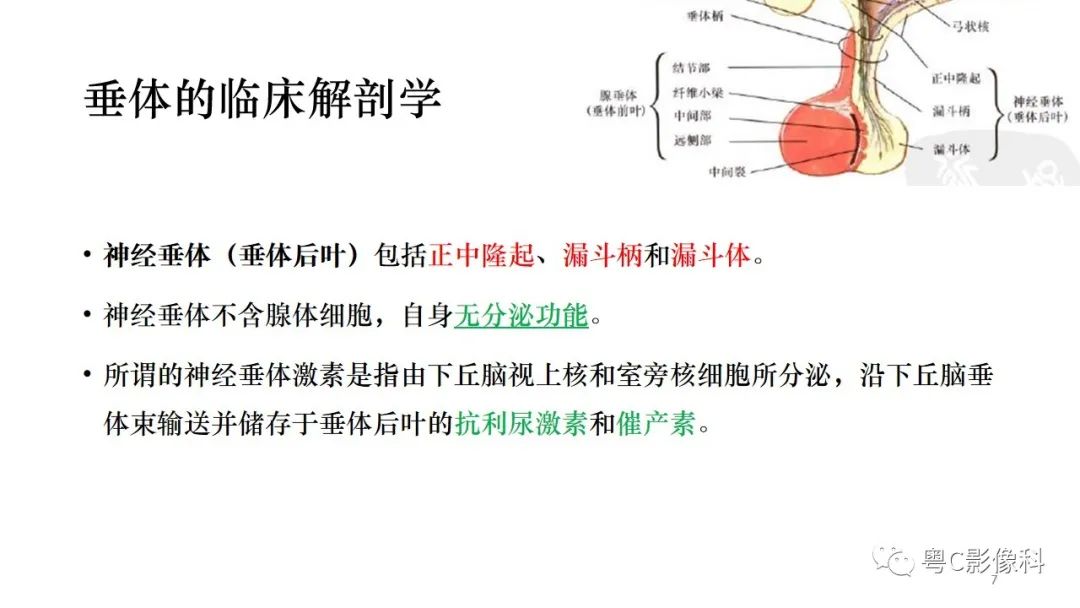影像PPT - 【PPT】垂体的正常MR表现及儿童垂体病变的MR表现-7