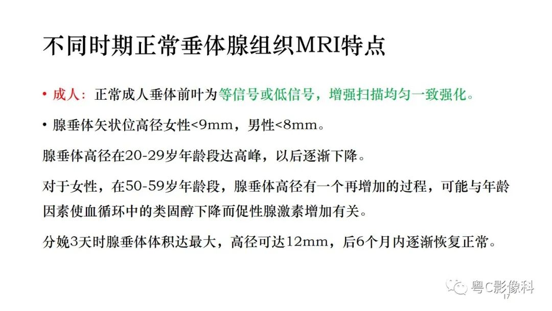 影像PPT - 【PPT】垂体的正常MR表现及儿童垂体病变的MR表现-17