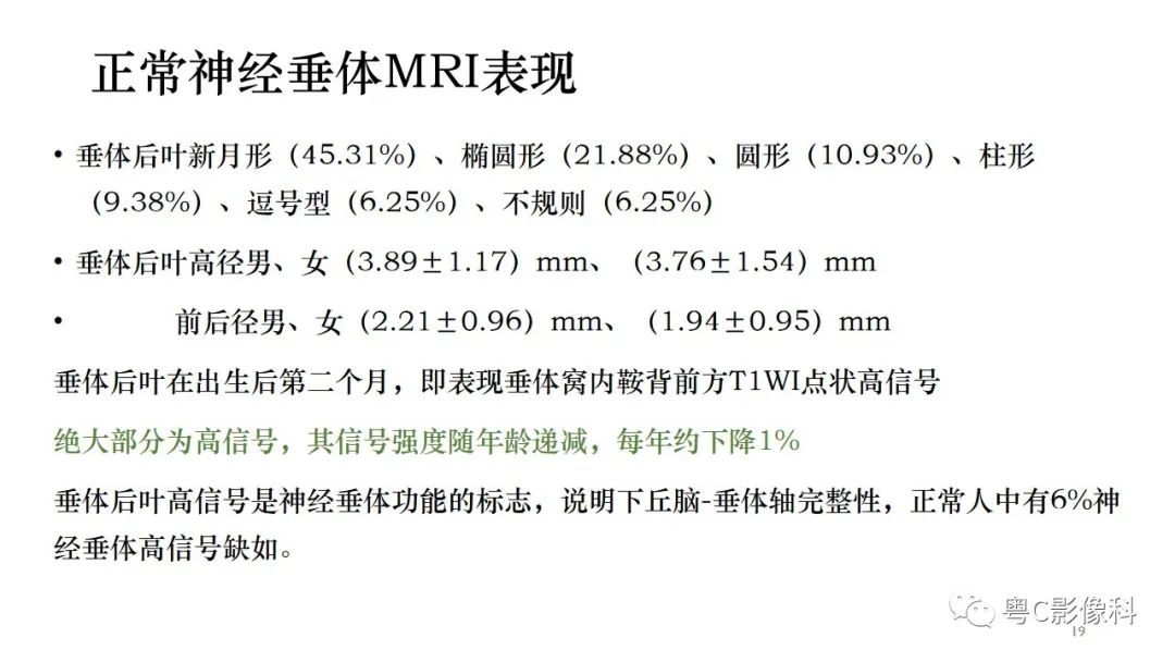 影像PPT - 【PPT】垂体的正常MR表现及儿童垂体病变的MR表现-19