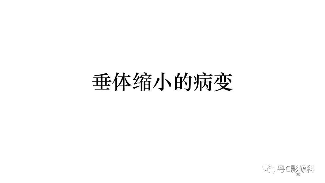 影像PPT - 【PPT】垂体的正常MR表现及儿童垂体病变的MR表现-20