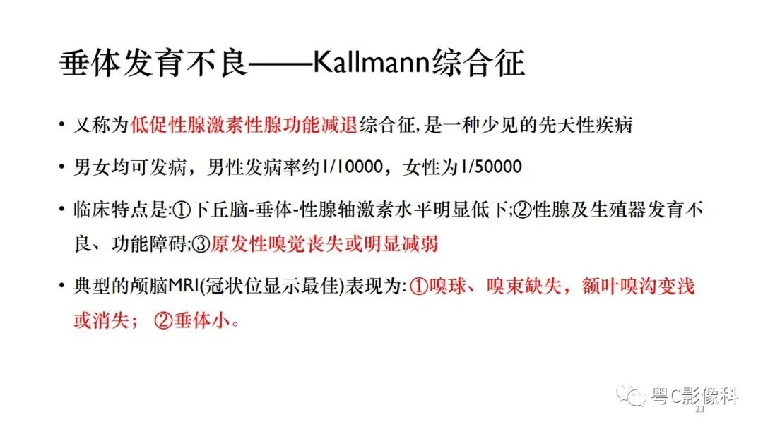 影像PPT - 【PPT】垂体的正常MR表现及儿童垂体病变的MR表现-23