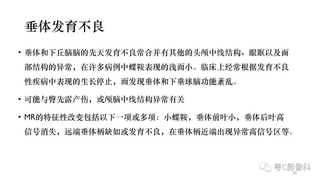 影像PPT - 【PPT】垂体的正常MR表现及儿童垂体病变的MR表现-22