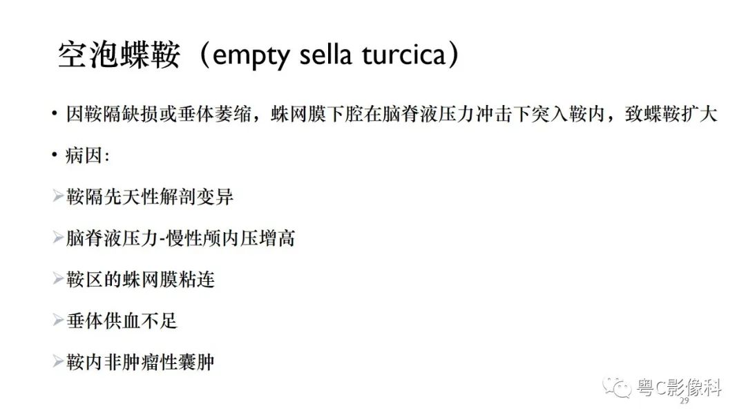 影像PPT - 【PPT】垂体的正常MR表现及儿童垂体病变的MR表现-29