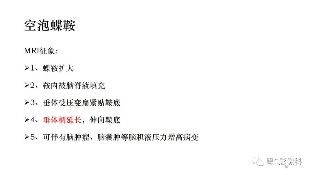 影像PPT - 【PPT】垂体的正常MR表现及儿童垂体病变的MR表现-30