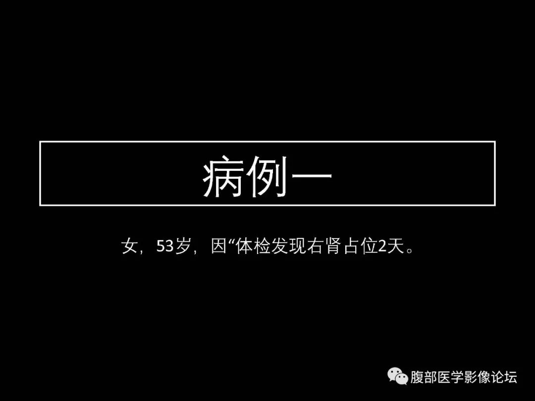 影像PPT - 【病例】肾脏透明细胞癌1例CT影像-1