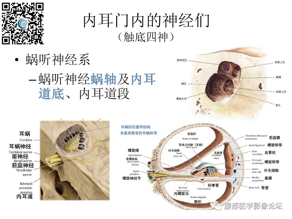 影像PPT - 【PPT】颅骨颅底系列之触底四神共一门-4