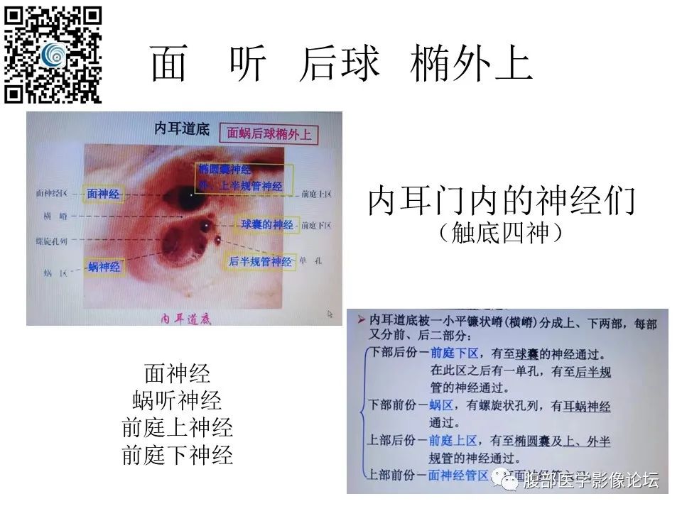 影像PPT - 【PPT】颅骨颅底系列之触底四神共一门-9