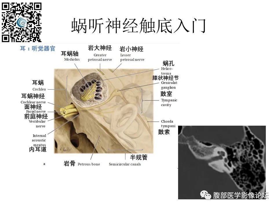 影像PPT - 【PPT】颅骨颅底系列之触底四神共一门-10