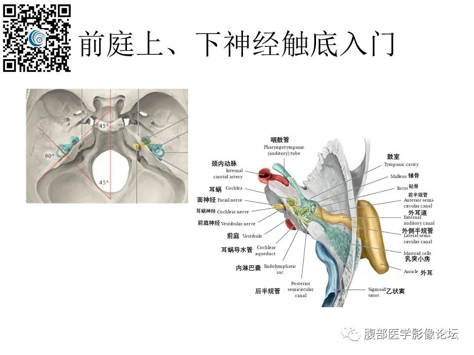 影像PPT - 【PPT】颅骨颅底系列之触底四神共一门-13
