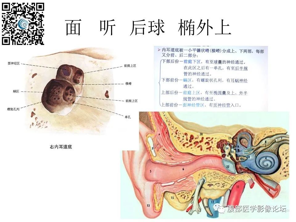 影像PPT - 【PPT】颅骨颅底系列之触底四神共一门-21