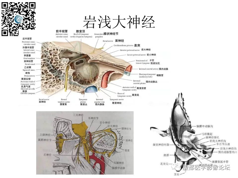 影像PPT - 【PPT】颅骨颅底系列之触底四神共一门-52