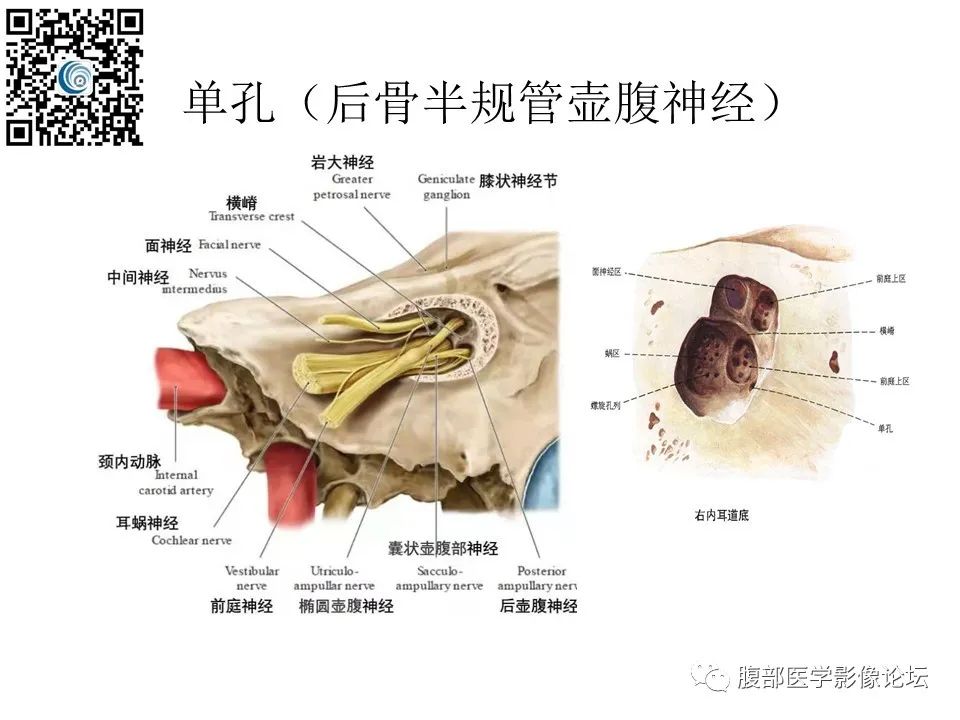 影像PPT - 【PPT】颅骨颅底系列之触底四神共一门-53