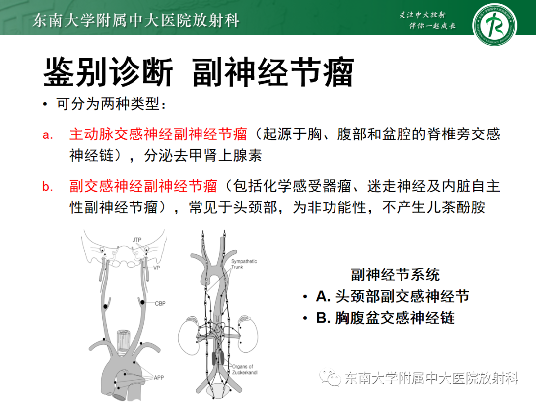 影像PPT - 【PPT】腹膜后平滑肌肉瘤的影像-18