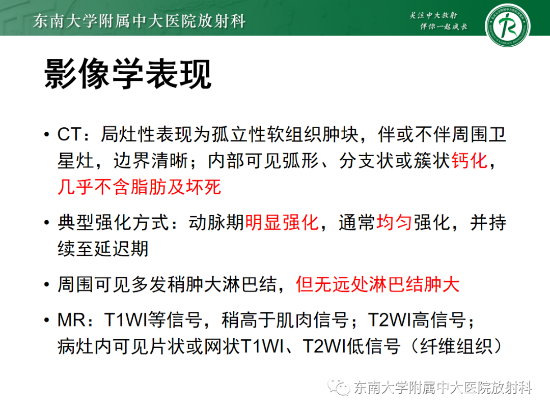 影像PPT - 【PPT】腹膜后平滑肌肉瘤的影像-34