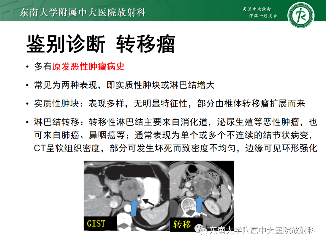 影像PPT - 【PPT】腹膜后平滑肌肉瘤的影像-41