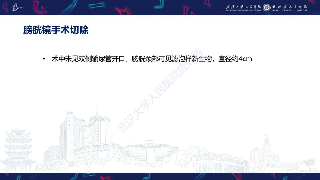 影像PPT - 【PPT】膀胱肾源性腺瘤影像诊断-11