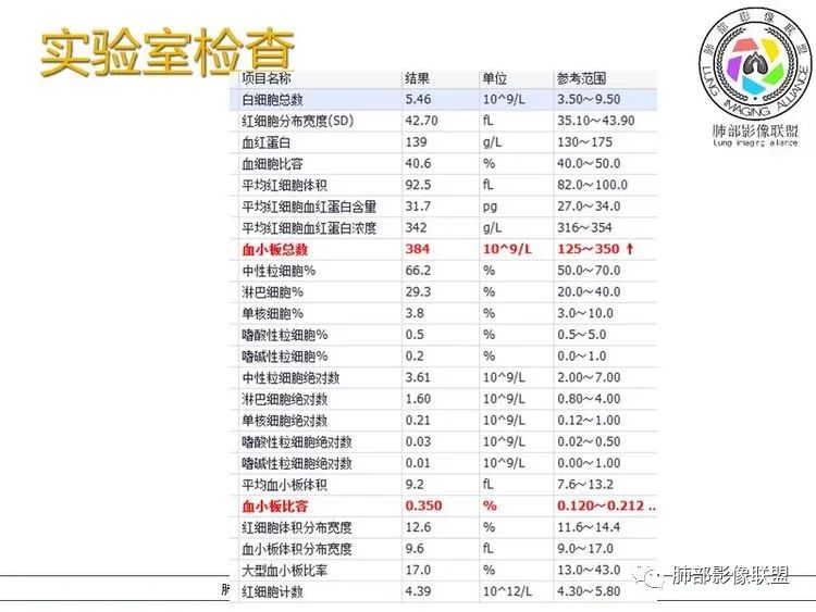 影像PPT - 【病例】跨叶的病变1例CT影像-3 影像PPT - 【病例】跨叶的病变1例CT影像-3
