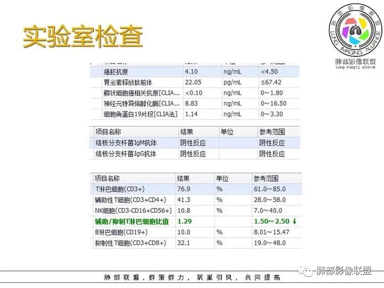 影像PPT - 【病例】跨叶的病变1例CT影像-4 影像PPT - 【病例】跨叶的病变1例CT影像-4