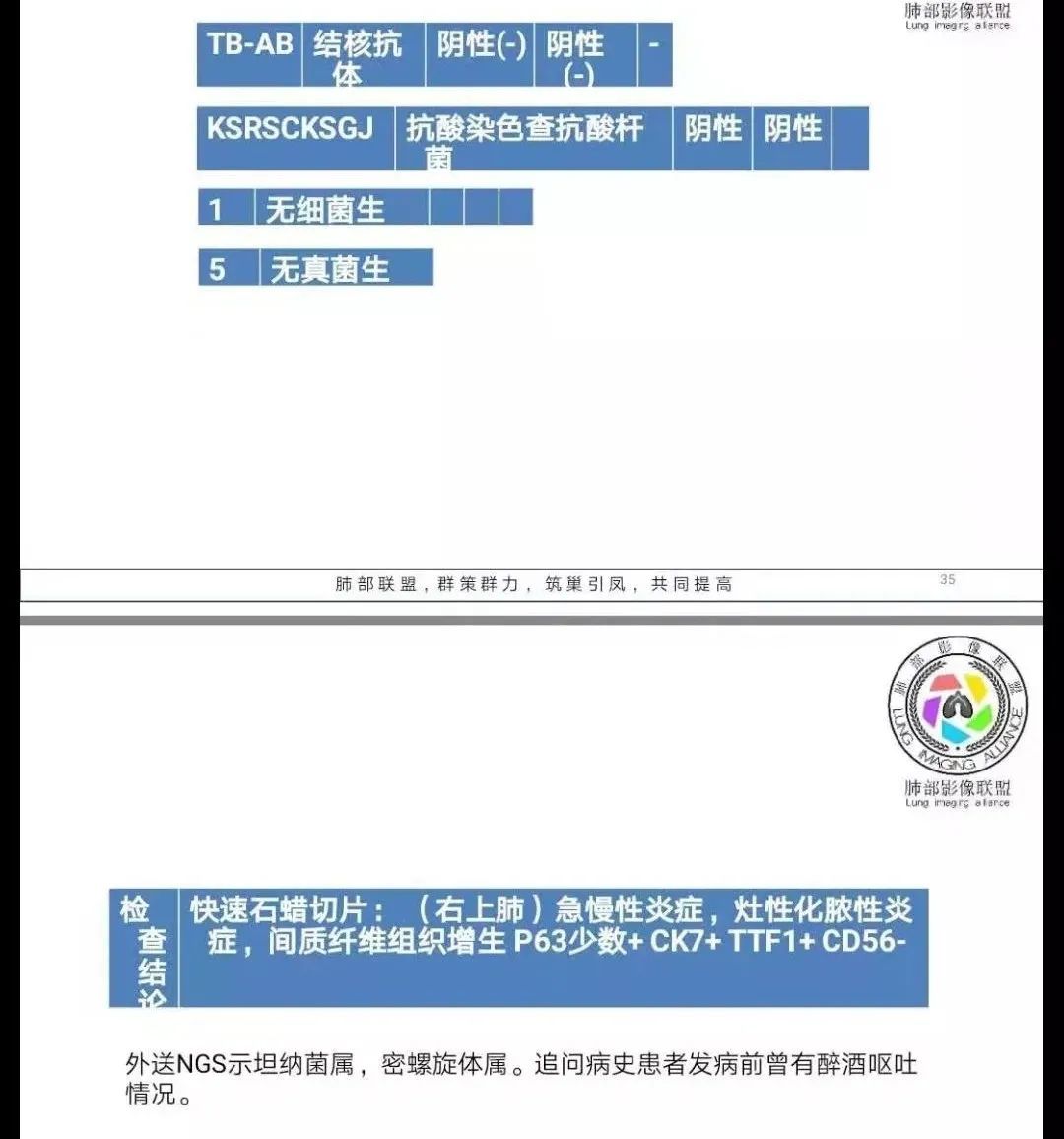 影像PPT - 【病例】跨叶的病变1例CT影像-21 影像PPT - 【病例】跨叶的病变1例CT影像-21