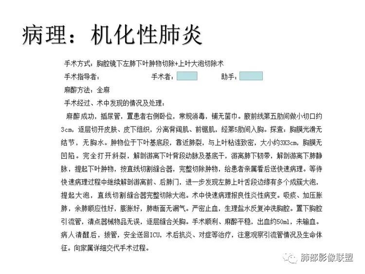 影像PPT - 【病例】跨叶的病变1例CT影像-16 影像PPT - 【病例】跨叶的病变1例CT影像-16