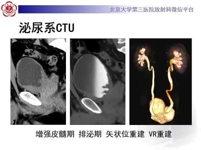 影像PPT - 【PPT】囊性及腺性膀胱炎-7