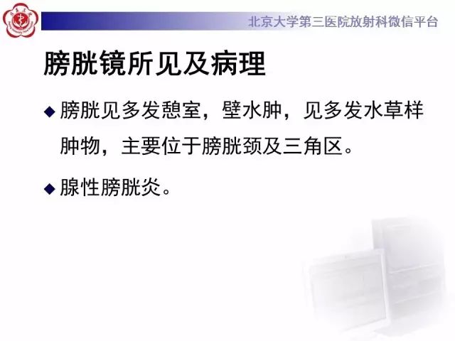 影像PPT - 【PPT】囊性及腺性膀胱炎-9
