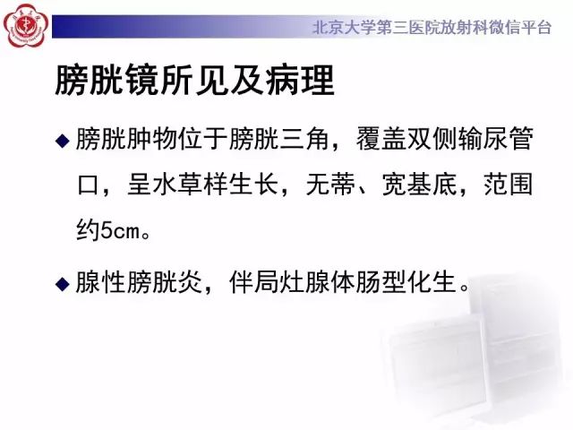 影像PPT - 【PPT】囊性及腺性膀胱炎-15