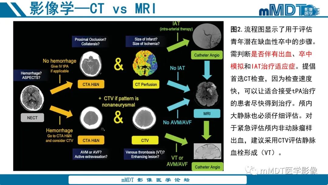 影像PPT - 【PPT】青年缺血性脑卒中:影像学综述-14 影像PPT - 【PPT】青年缺血性脑卒中:影像学综述-14