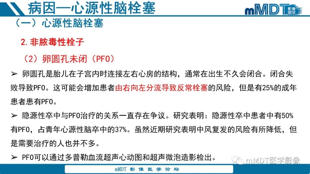 影像PPT - 【PPT】青年缺血性脑卒中:影像学综述-26 影像PPT - 【PPT】青年缺血性脑卒中:影像学综述-26