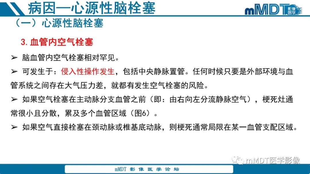 影像PPT - 【PPT】青年缺血性脑卒中:影像学综述-28 影像PPT - 【PPT】青年缺血性脑卒中:影像学综述-28