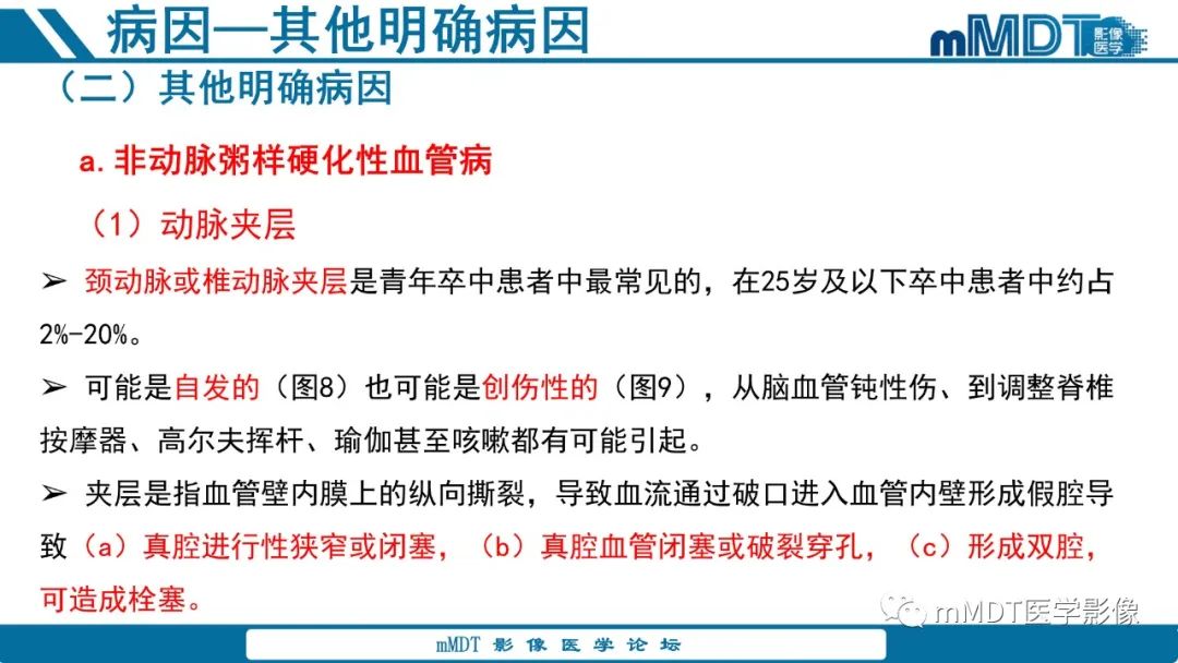 影像PPT - 【PPT】青年缺血性脑卒中:影像学综述-34 影像PPT - 【PPT】青年缺血性脑卒中:影像学综述-34