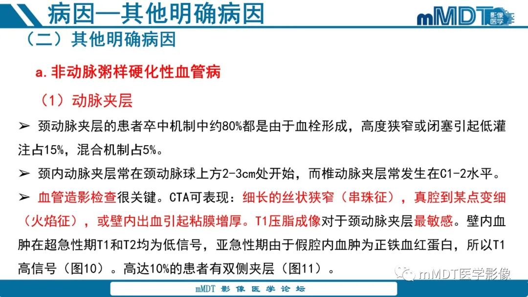 影像PPT - 【PPT】青年缺血性脑卒中:影像学综述-35 影像PPT - 【PPT】青年缺血性脑卒中:影像学综述-35