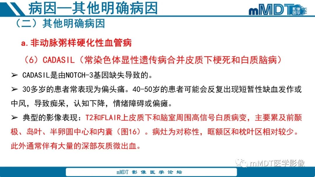 影像PPT - 【PPT】青年缺血性脑卒中:影像学综述-51 影像PPT - 【PPT】青年缺血性脑卒中:影像学综述-51