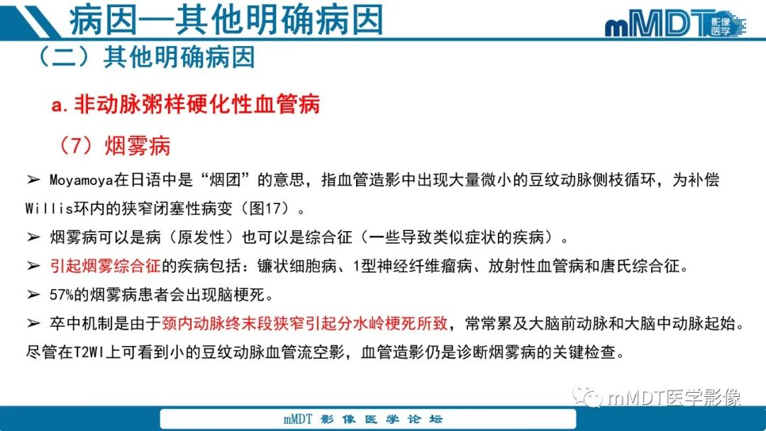 影像PPT - 【PPT】青年缺血性脑卒中:影像学综述-53 影像PPT - 【PPT】青年缺血性脑卒中:影像学综述-53