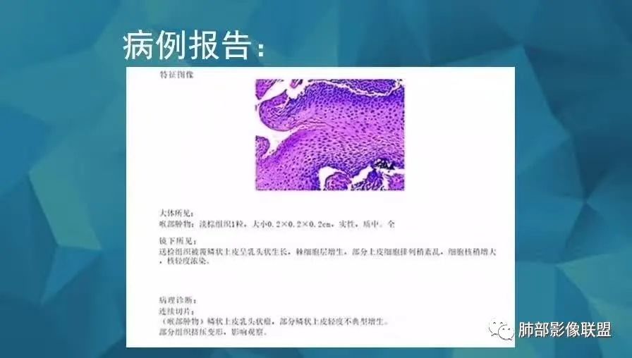 影像PPT - 【PPT】气管支气管乳头状瘤病-31 影像PPT - 【PPT】气管支气管乳头状瘤病-31