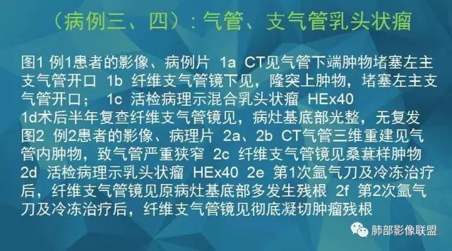 影像PPT - 【PPT】气管支气管乳头状瘤病-35 影像PPT - 【PPT】气管支气管乳头状瘤病-35