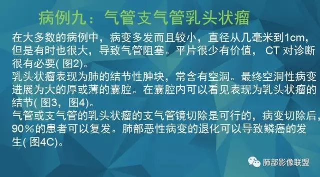影像PPT - 【PPT】气管支气管乳头状瘤病-43 影像PPT - 【PPT】气管支气管乳头状瘤病-43