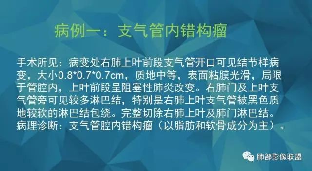 影像PPT - 【PPT】气管支气管乳头状瘤病-53 影像PPT - 【PPT】气管支气管乳头状瘤病-53