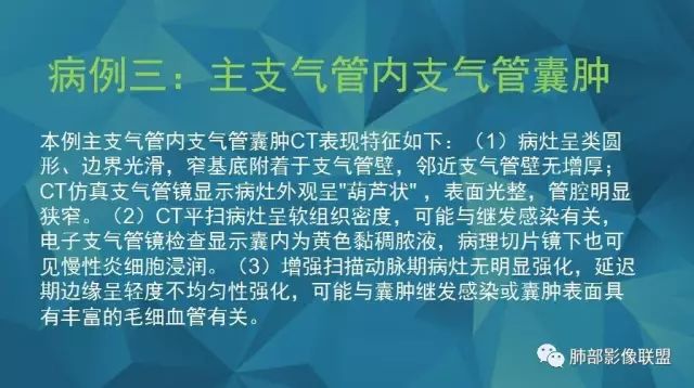 影像PPT - 【PPT】气管支气管乳头状瘤病-58 影像PPT - 【PPT】气管支气管乳头状瘤病-58