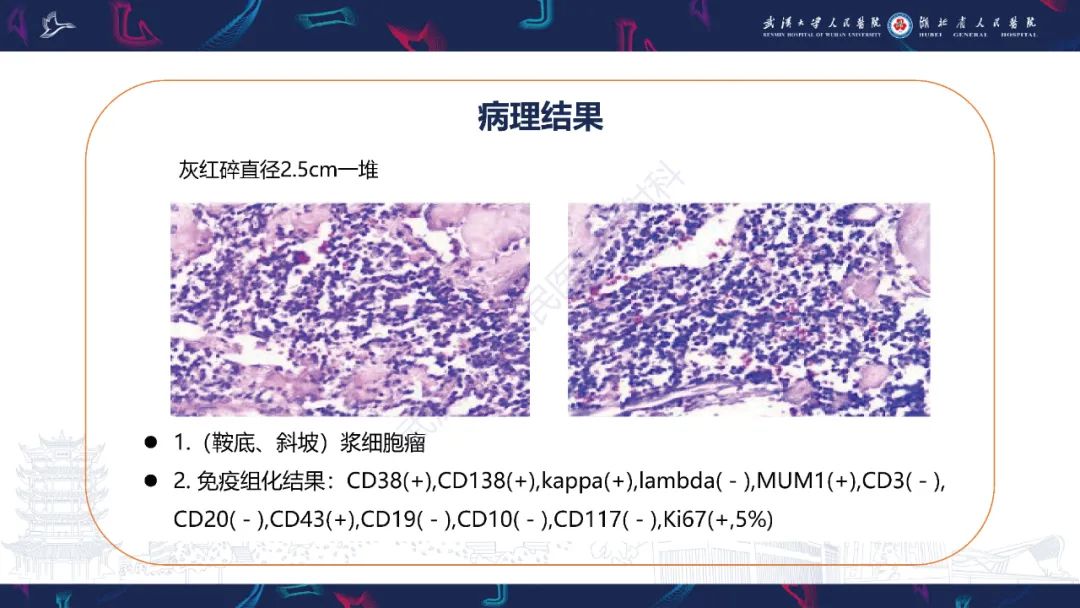 影像PPT - 【PPT】斜坡肿瘤影像诊断-7