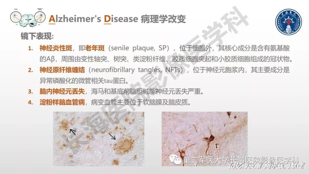 影像PPT - 【PPT】阿尔兹海默症 ——临床与影像-8