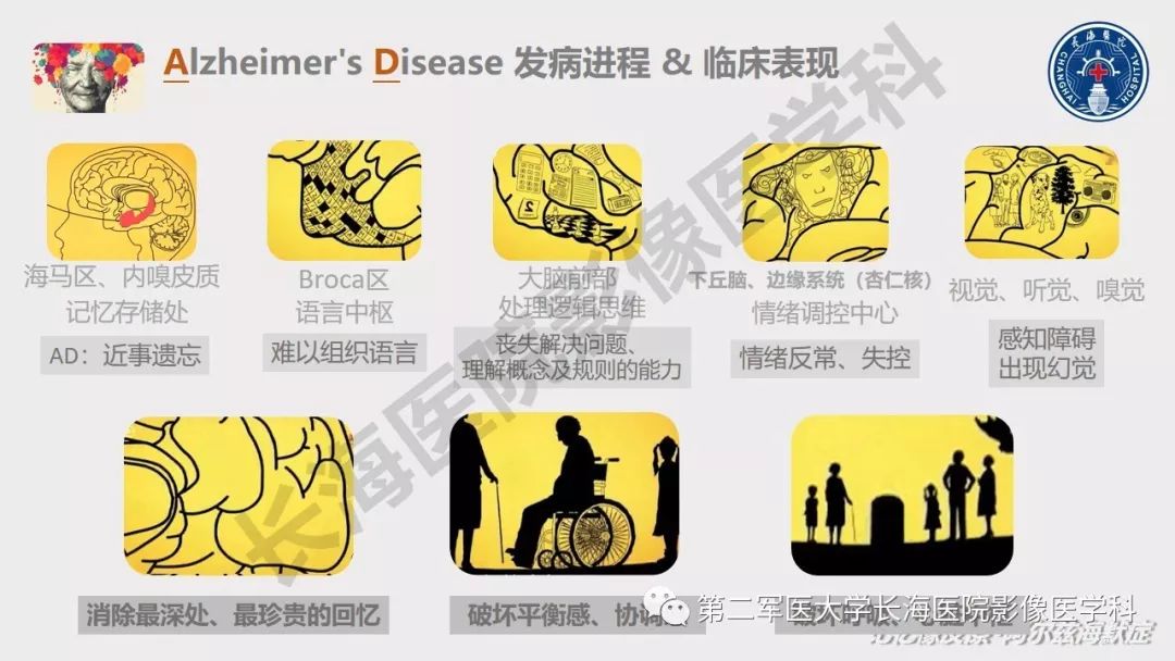 影像PPT - 【PPT】阿尔兹海默症 ——临床与影像-10