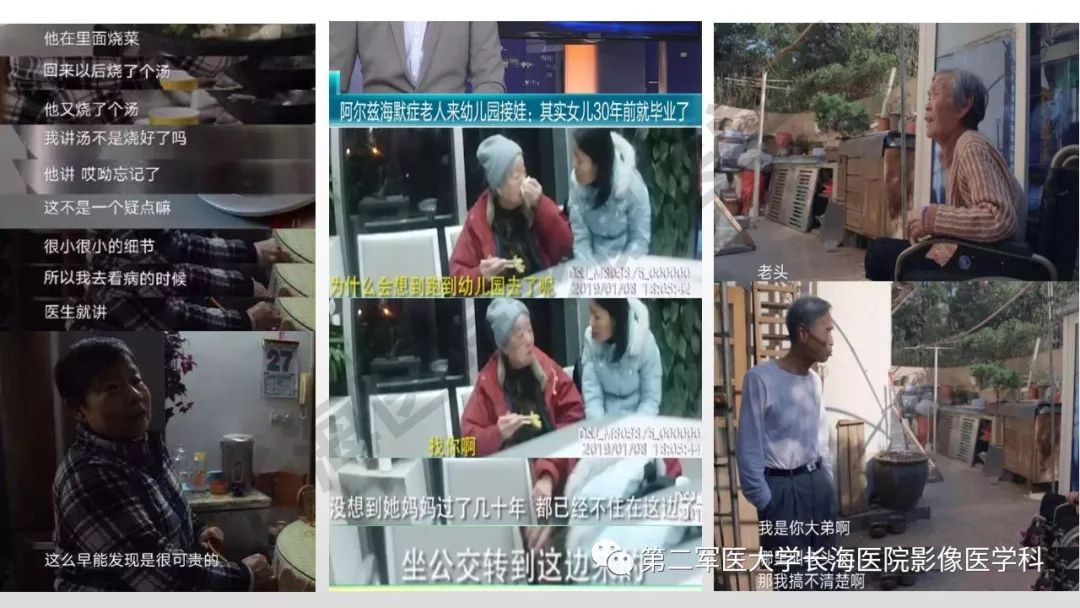 影像PPT - 【PPT】阿尔兹海默症 ——临床与影像-13