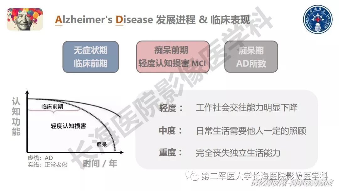 影像PPT - 【PPT】阿尔兹海默症 ——临床与影像-12