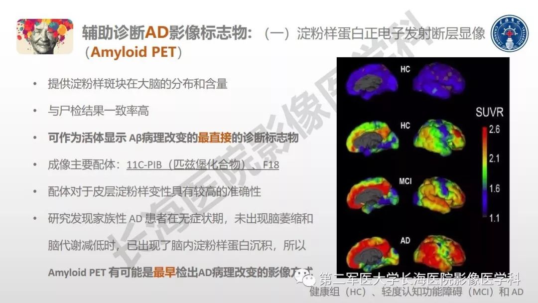 影像PPT - 【PPT】阿尔兹海默症 ——临床与影像-23