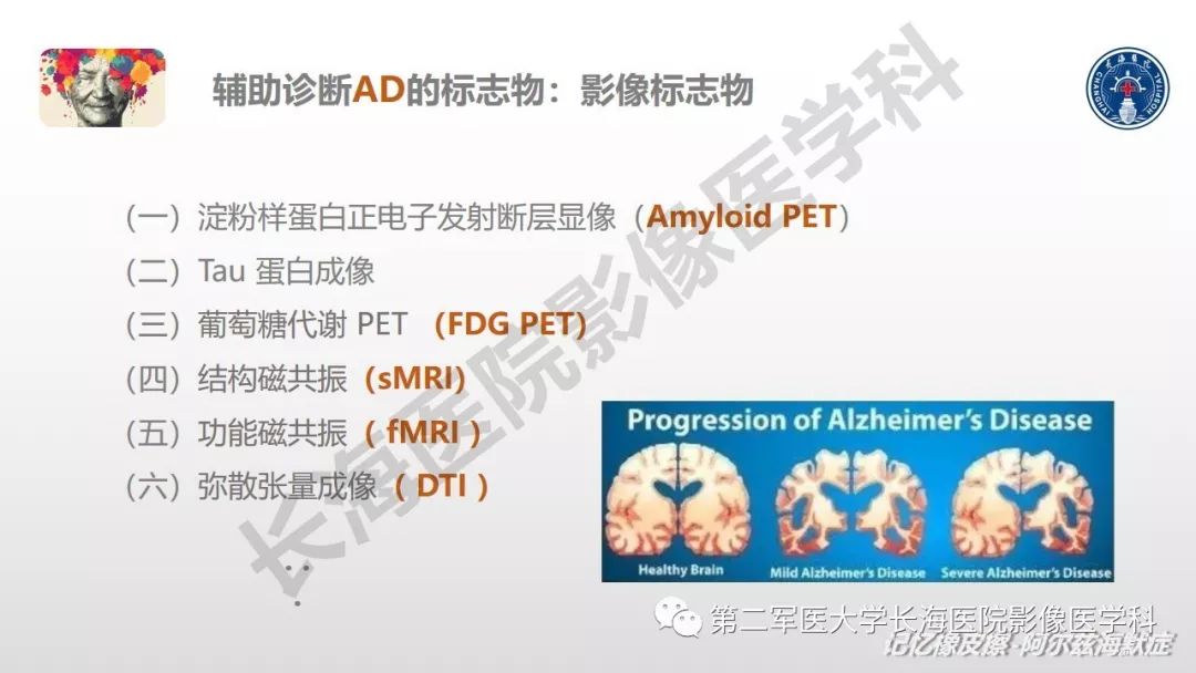 影像PPT - 【PPT】阿尔兹海默症 ——临床与影像-22