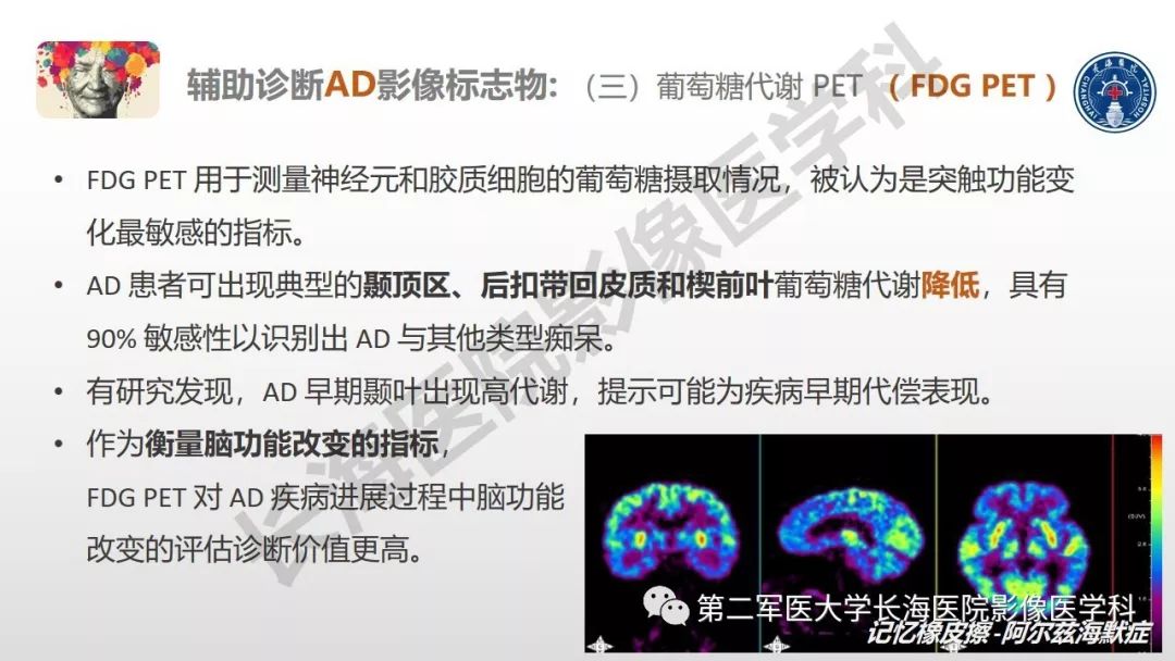 影像PPT - 【PPT】阿尔兹海默症 ——临床与影像-25
