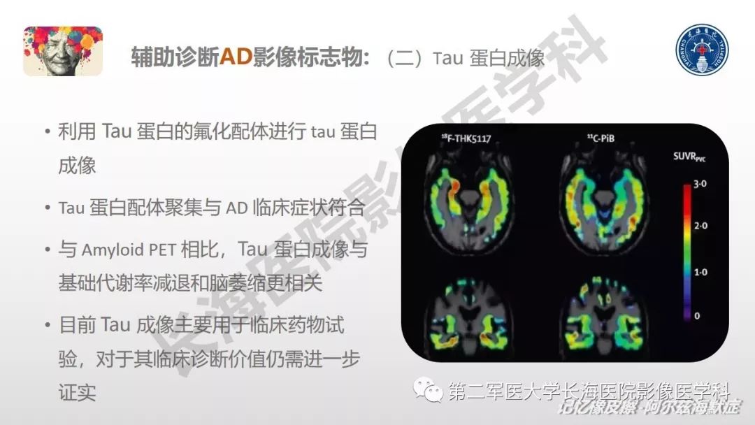 影像PPT - 【PPT】阿尔兹海默症 ——临床与影像-24